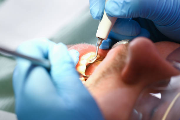 Best Broken or Cracked Tooth Emergency Dentist in Tyrone, PA